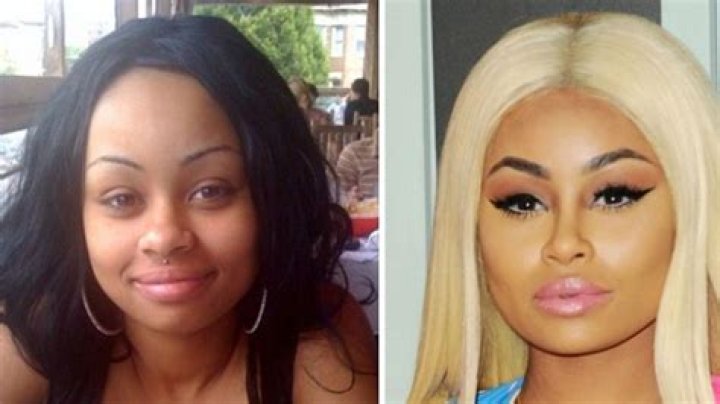 Blac Chyna Plastic Surgery