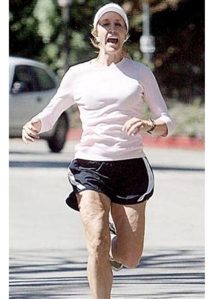 Celebs With Cellulite