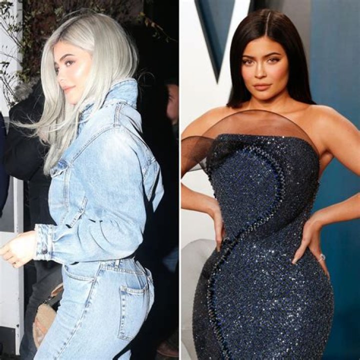 Does Kylie Jenner Have Butt Implants?
