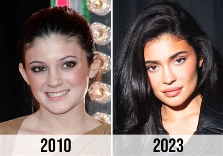 Kylie Jenner: Before & After Superstardom
