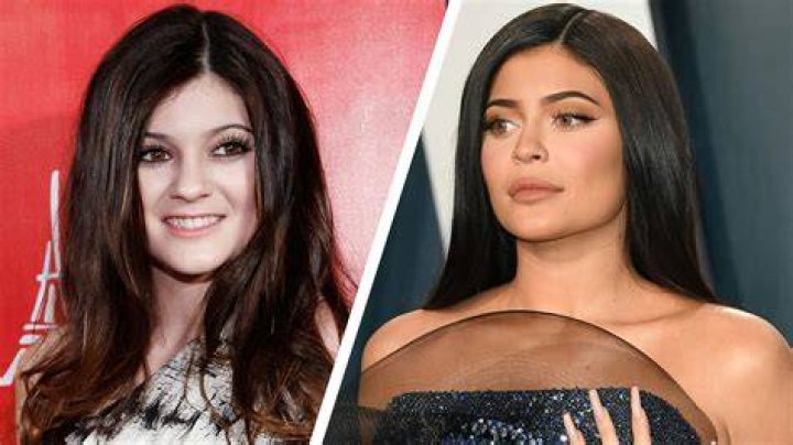 Kylie Jenner Then & Now